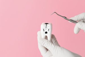 Decay Tooth Treatment check